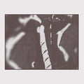 MRI |